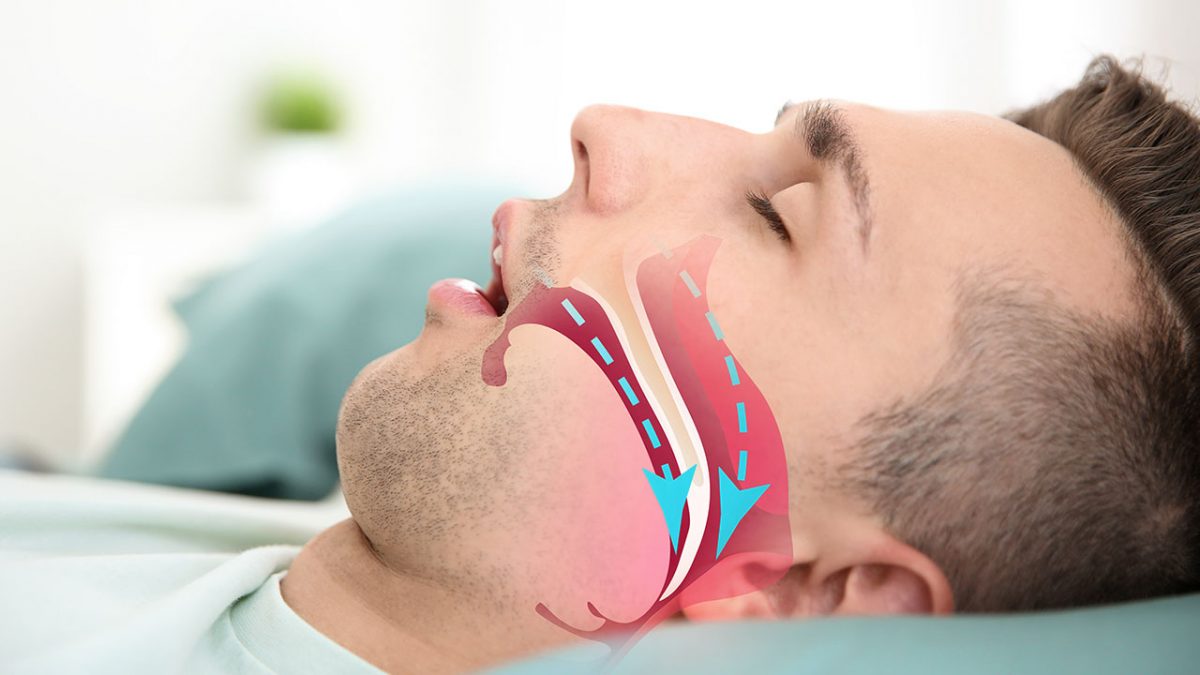 Carne Esponjosa no nariz e a dificuldade para respirar | Otorrino Marco